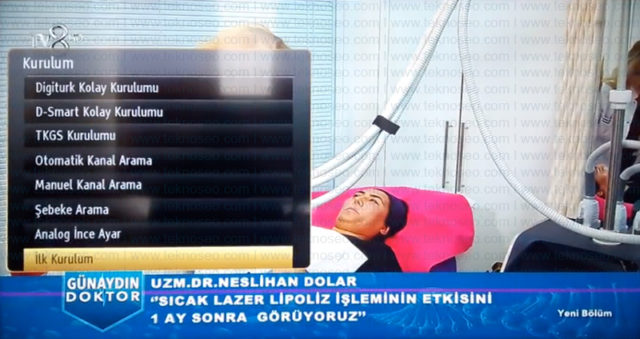 seg smart tv,turksat 4a,uydu ayarları,kanal arama,sinyal yok